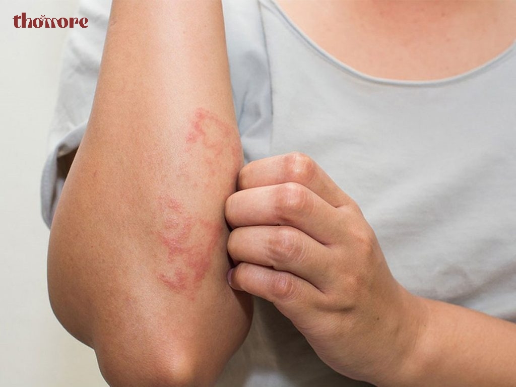 Cách Phân Biệt Nước Hoa Thật Giả Chuẩn Nhất Ai Cũng Nên Biết 2 Một số tác hại khi dùng phải nước hoa giả